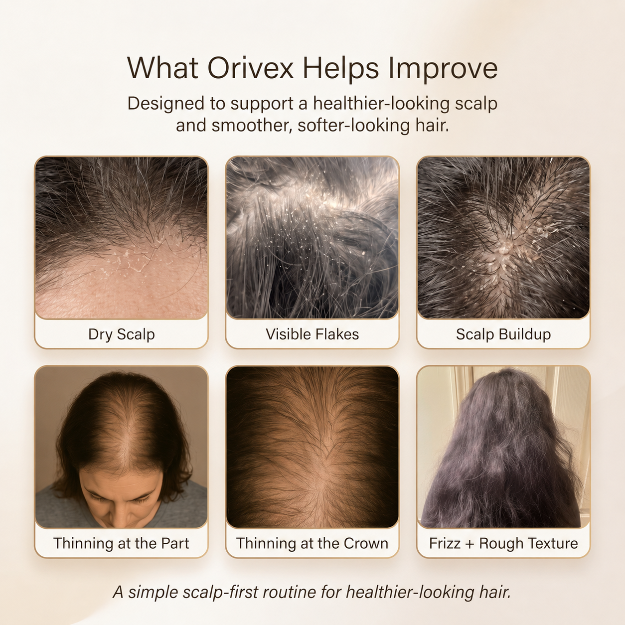 Orivex™ 3-in-1 Steam Hair Therapy Brush