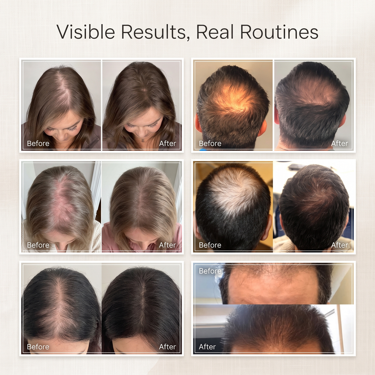 Orivex™ 3-in-1 Steam Hair Therapy Brush